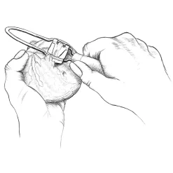 J.Porkert export-import Apfelsinenschäler New